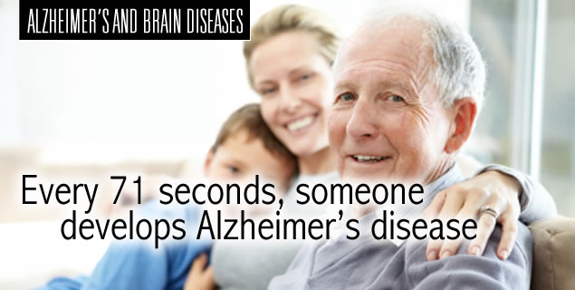 alzheimers