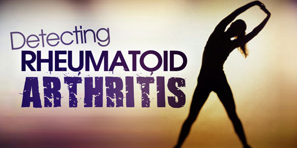 Symptoms of Rheumatoid Arthritis